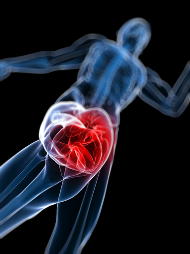 acl surgical procedure failure
