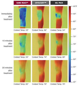 Cold Compression: The Importance Of Evidence Based Practices Cold Compression: The Importance Of Evidence Based Practices