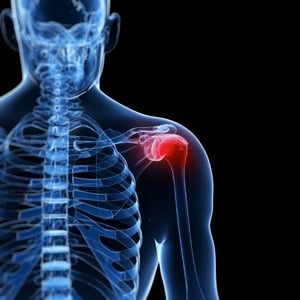 How to Alleviate Pain During Rotator Cuff Injury Recovery