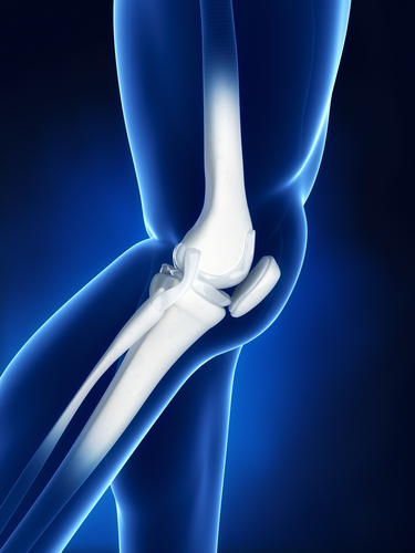 acl surgery recovery
